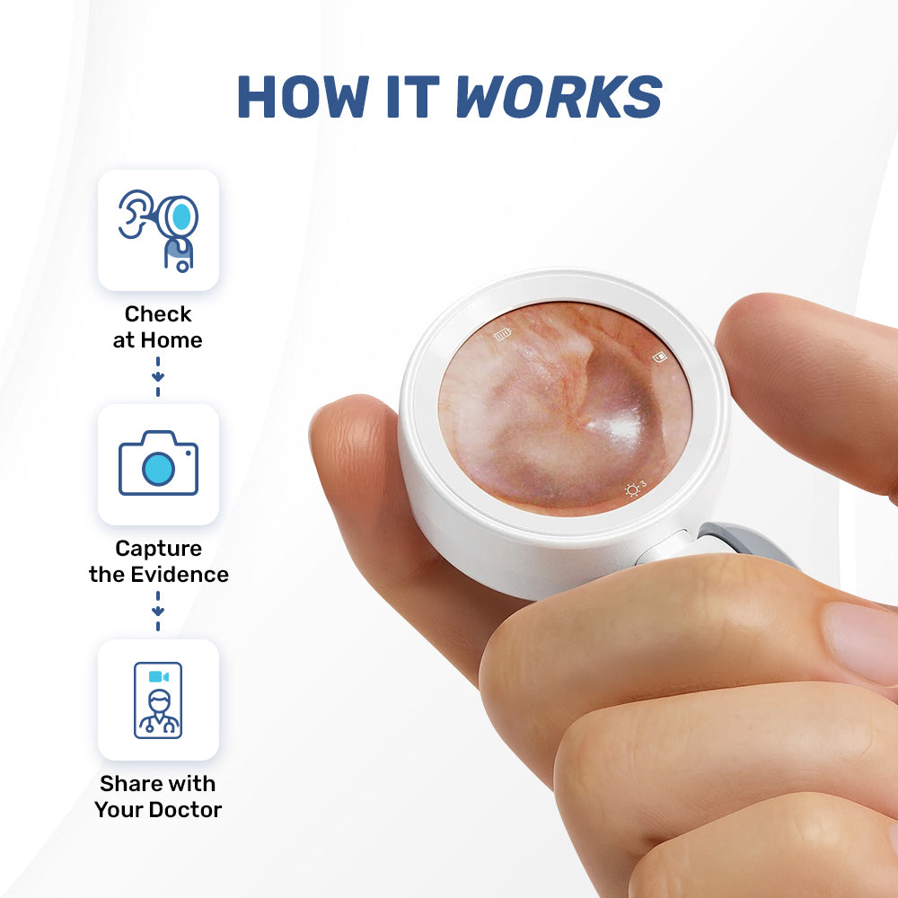 Peeksy Smart Otoscope