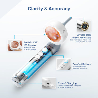 Peeksy Smart Otoscope